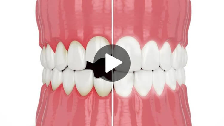 Thumbnail image for an education video on cosmetic dentistry